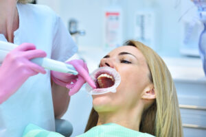How to Choose the Right Aligner Treatment Planning Service